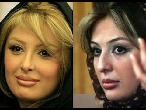بازیگران مشهور ایرانی قبل از عمل بینی جعبه