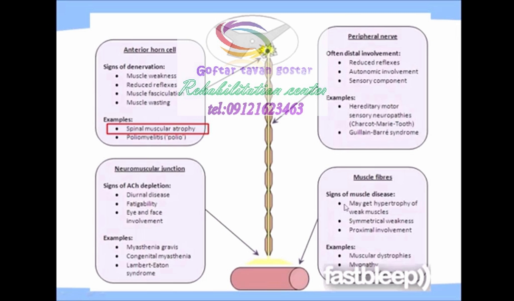 مراکز تخصصی کاردرمانی و فیزیوتراپی در کرج|گفتار توان گستر البرز 09121623463