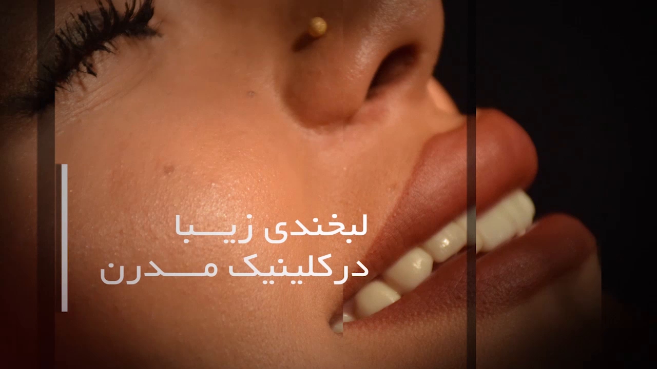 مراحل کاشت ایمپلنت دندان