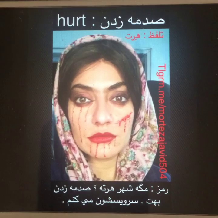 مگه شهرهرته که بهت صدمه زدن؟!